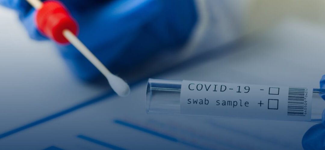 Conoce qué prueba es mejor para el Covid 19 en la actualidad