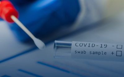 Conoce qué prueba es mejor para el Covid 19 en la actualidad
