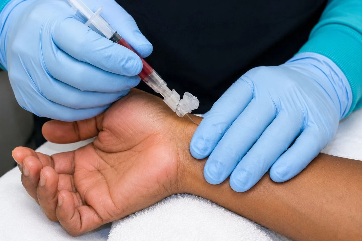 Toma de muestra para gasometría arterial mediante punción en arteria radial