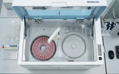 ¿Qué capacidades y rendimiento ofrecen los fotómetros bioquímicos automatizados?
