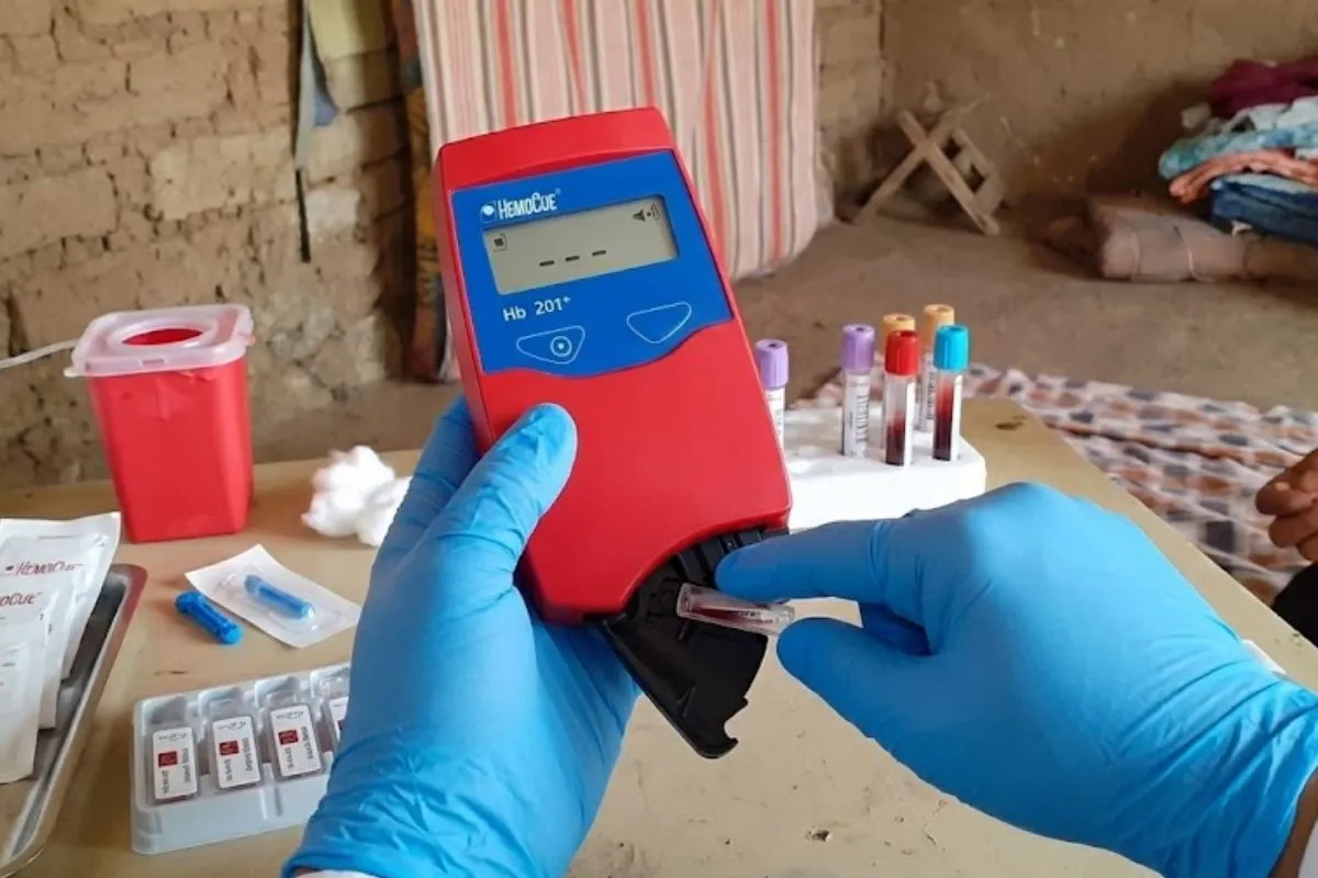 Vista POV de un especialista utilizando un hemoglobinómetro HemoCue Hb 201+ para analizar muestras de sangre en una vivienda rural.