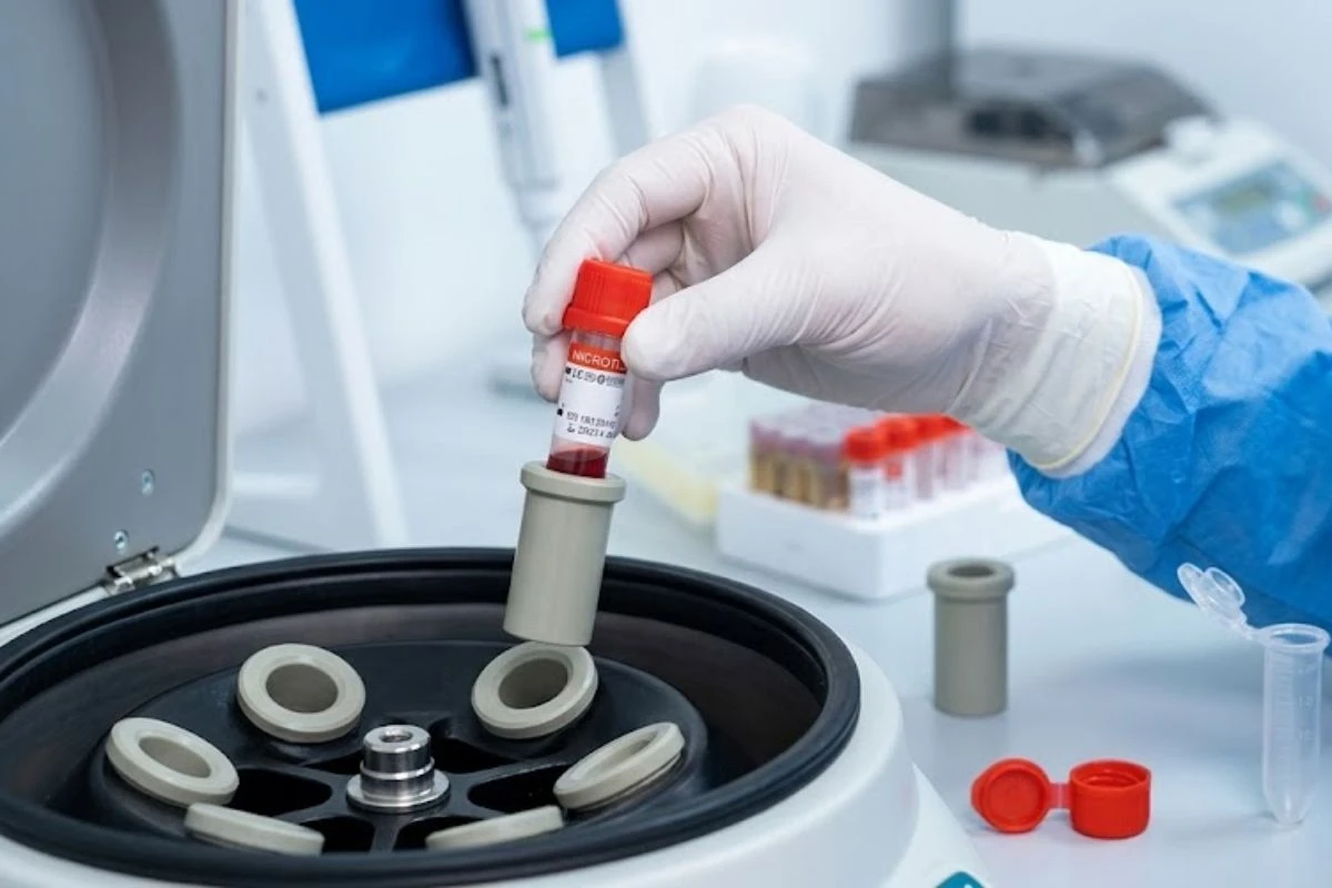 Tecnólogo médico colocando un microtubo de tapa roja con muestra de sangre en un adaptador de centrífuga dentro de un laboratorio clínico.